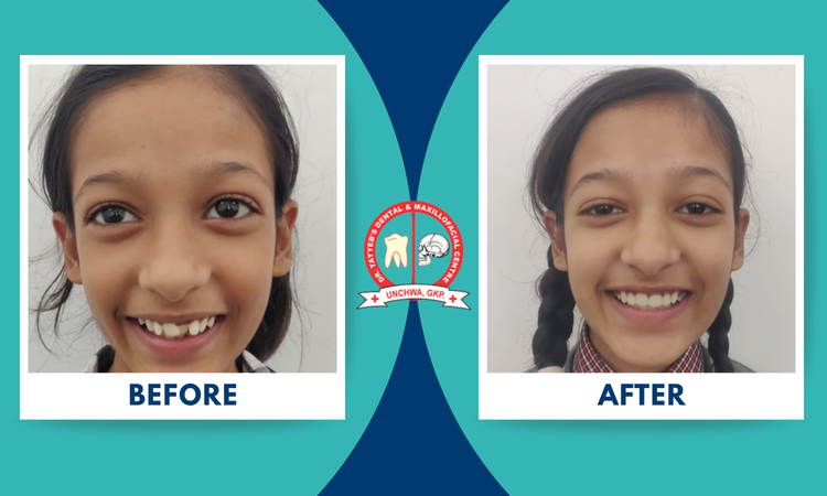 braces treatment at dr tayyeb's